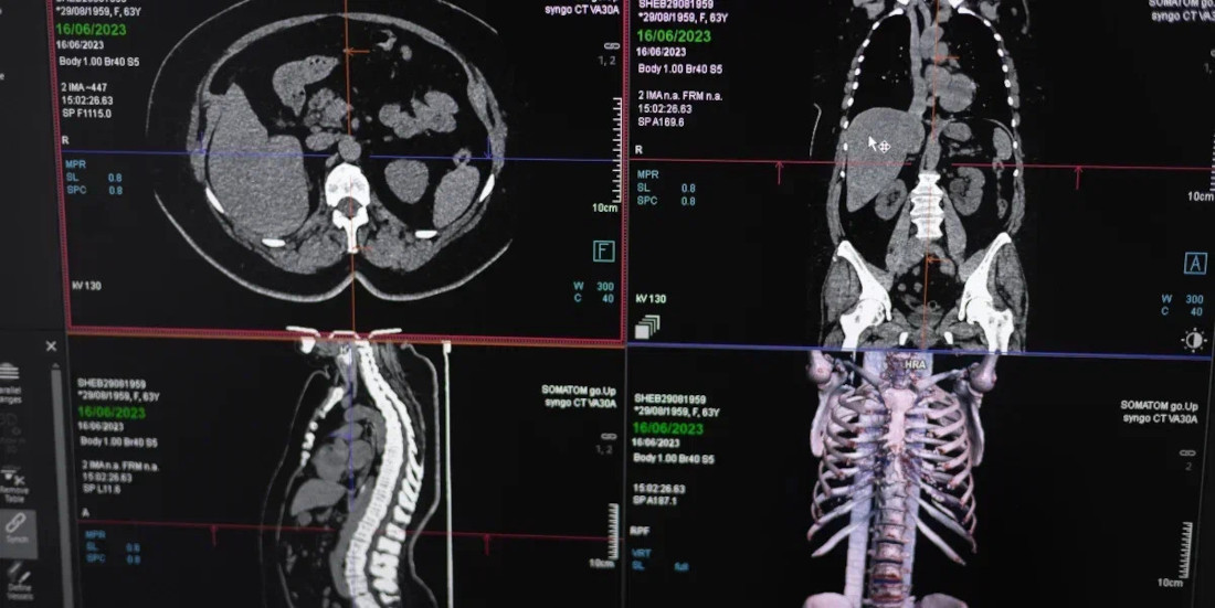 Что можно исследовать при помощи КТ